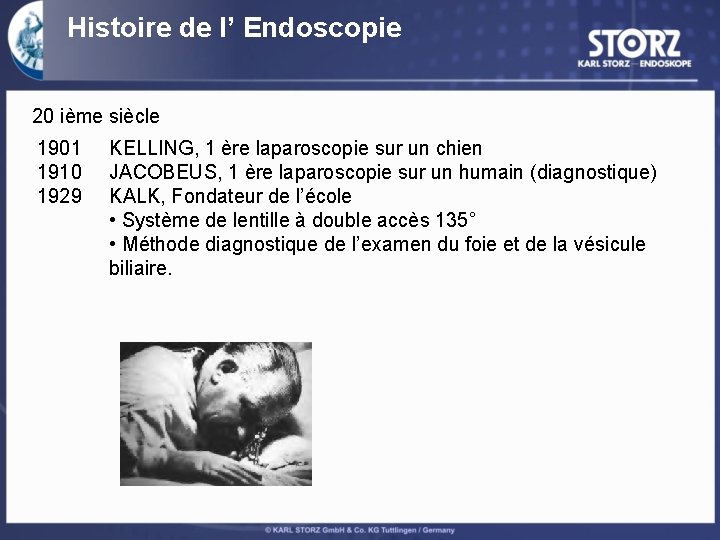 Histoire de l’ Endoscopie 20 ième siècle 1901 1910 1929 KELLING, 1 ère laparoscopie