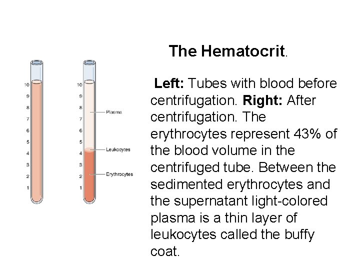 The Hematocrit. Left: Tubes with blood before centrifugation. Right: After centrifugation. The erythrocytes represent The Hematocrit. Left: Tubes with blood before centrifugation. Right: After centrifugation. The erythrocytes represent