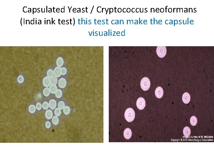 Capsulated Yeast / Cryptococcus neoformans (India ink test) this test can make the Capsulated Yeast / Cryptococcus neoformans (India ink test) this test can make the