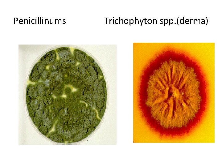 Penicillinums Trichophyton spp. (derma) Penicillinums Trichophyton spp. (derma)