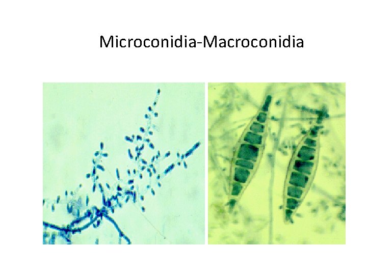 Microconidia-Macroconidia Microconidia-Macroconidia