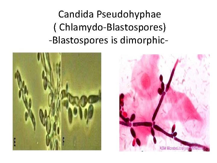 Candida Pseudohyphae ( Chlamydo-Blastospores) -Blastospores is dimorphic- Candida Pseudohyphae ( Chlamydo-Blastospores) -Blastospores is dimorphic-