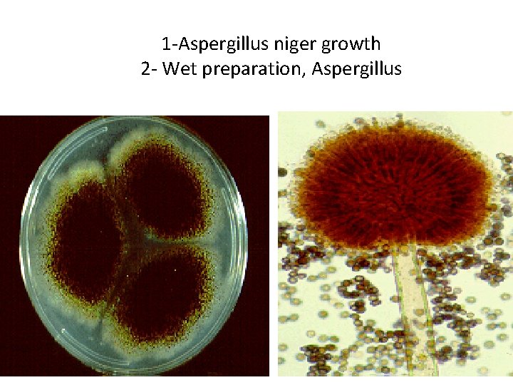 1 -Aspergillus niger growth 2 - Wet preparation, Aspergillus 1 -Aspergillus niger growth 2 - Wet preparation, Aspergillus