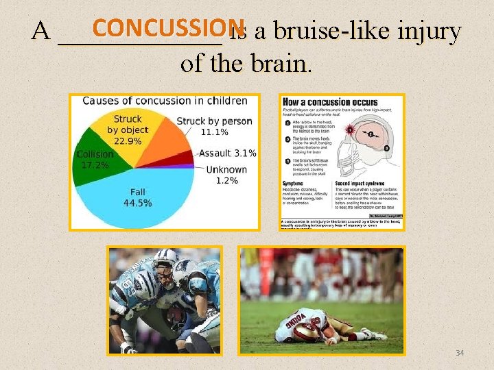 CONCUSSION A ______ is a bruise-like injury of the brain. 34 