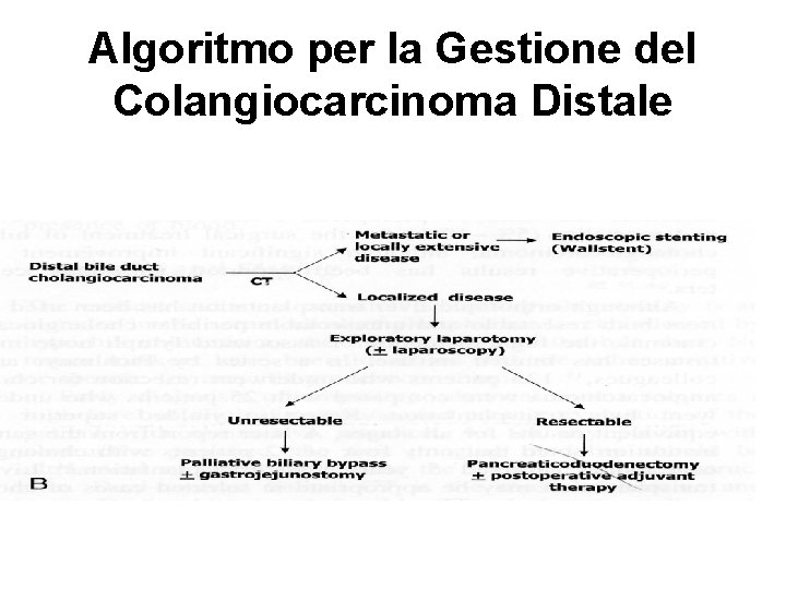 Algoritmo per la Gestione del Colangiocarcinoma Distale 