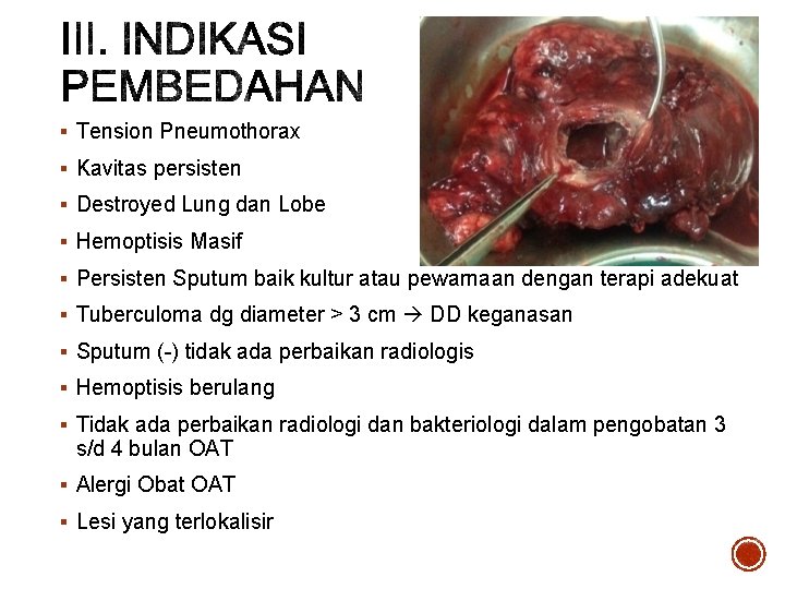 § Tension Pneumothorax § Kavitas persisten § Destroyed Lung dan Lobe § Hemoptisis Masif