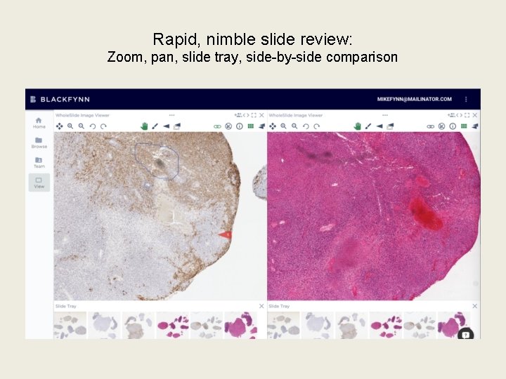 Rapid, nimble slide review: Zoom, pan, slide tray, side-by-side comparison 