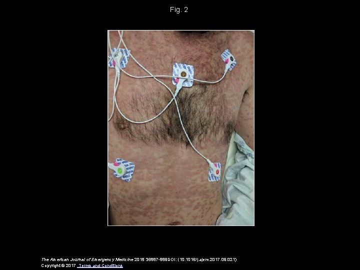 Fig. 2 The American Journal of Emergency Medicine 2018 36887 -889 DOI: (10. 1016/j.