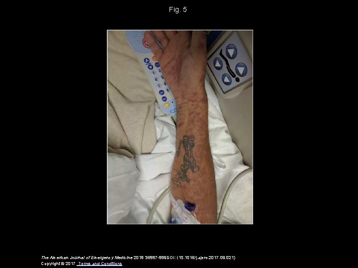 Fig. 5 The American Journal of Emergency Medicine 2018 36887 -889 DOI: (10. 1016/j.