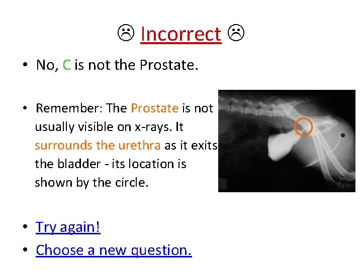  Incorrect • No, C is not the Prostate. • Remember: The Prostate is