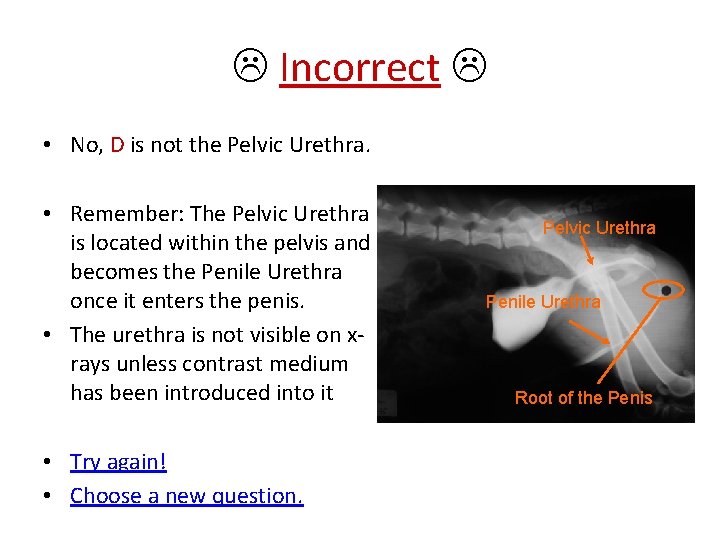  Incorrect • No, D is not the Pelvic Urethra. • Remember: The Pelvic