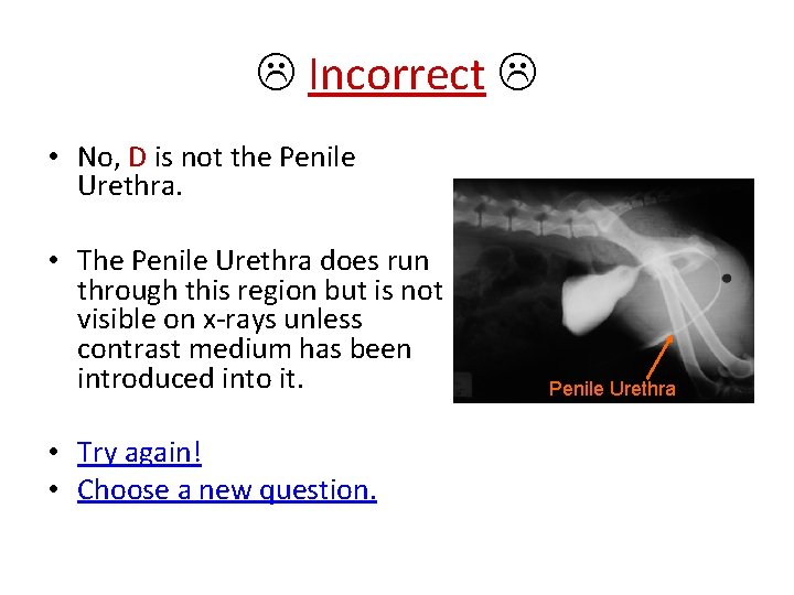  Incorrect • No, D is not the Penile Urethra. • The Penile Urethra