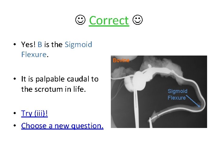  Correct • Yes! B is the Sigmoid Flexure. • It is palpable caudal