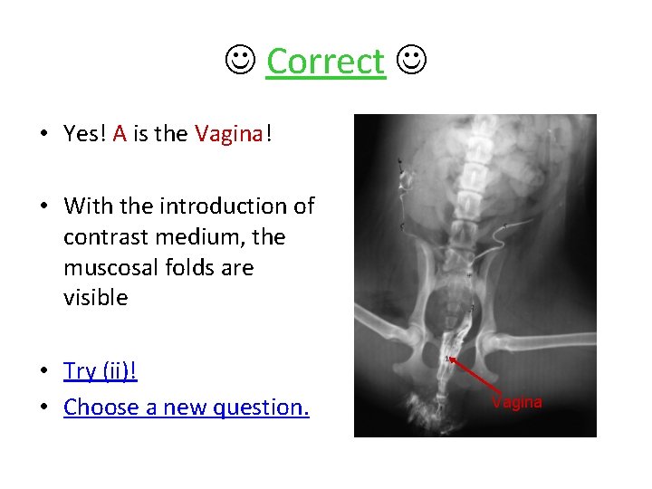  Correct • Yes! A is the Vagina! • With the introduction of contrast