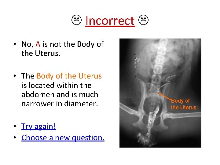  Incorrect • No, A is not the Body of the Uterus. • The