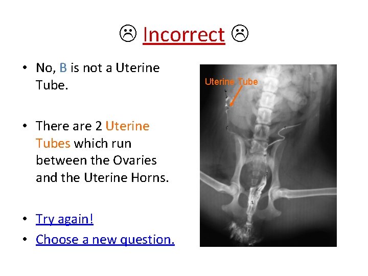  Incorrect • No, B is not a Uterine Tube. • There are 2