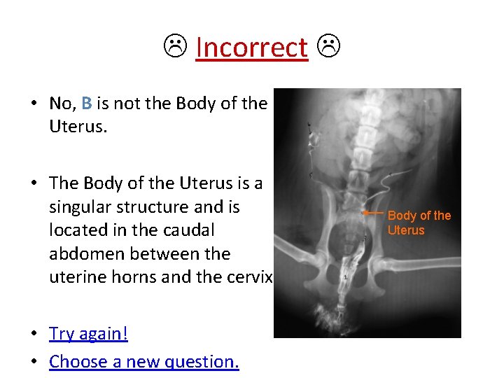  Incorrect • No, B is not the Body of the Uterus. • The