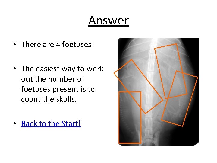 Answer • There are 4 foetuses! • The easiest way to work out the