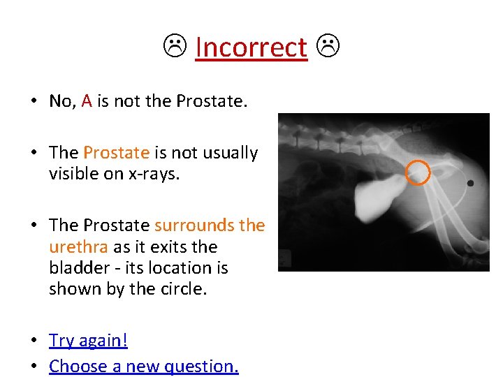  Incorrect • No, A is not the Prostate. • The Prostate is not