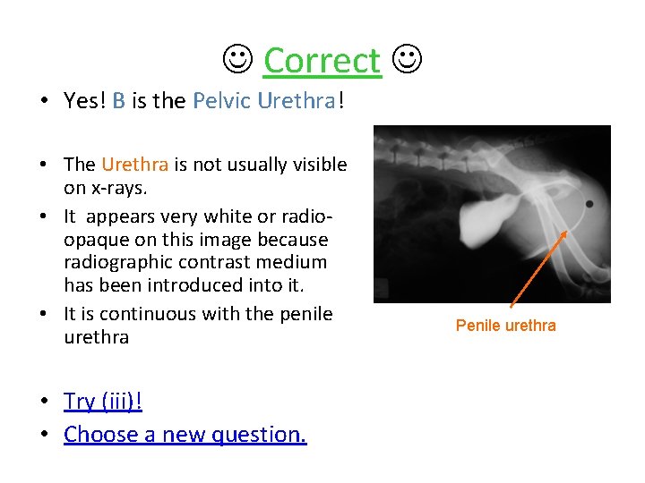  Correct • Yes! B is the Pelvic Urethra! • The Urethra is not