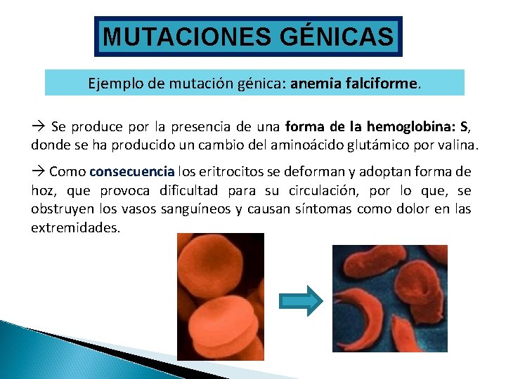 MUTACIONES GÉNICAS Ejemplo de mutación génica: anemia falciforme. Se produce por la presencia de