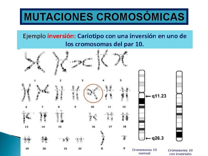 MUTACIONES CROMOSÓMICAS Ejemplo inversión: Cariotipo con una inversión en uno de los cromosomas del