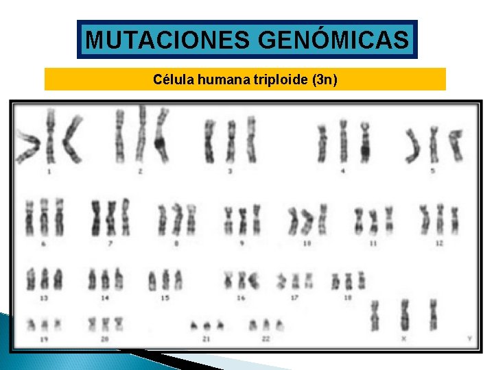 MUTACIONES GENÓMICAS Célula humana triploide (3 n) 