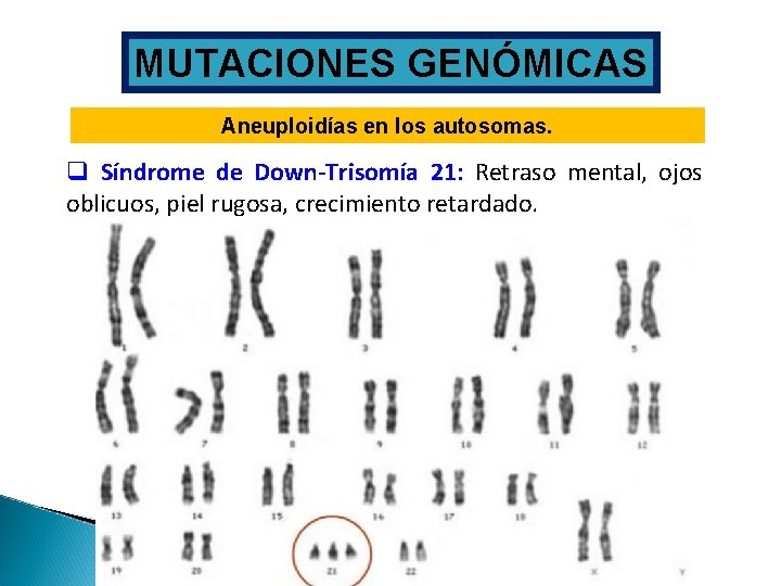 MUTACIONES GENÓMICAS Aneuploidías en los autosomas. q Síndrome de Down-Trisomía 21: Retraso mental, ojos