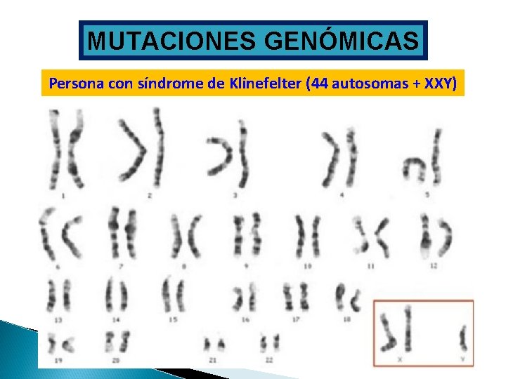 MUTACIONES GENÓMICAS Persona con síndrome de Klinefelter (44 autosomas + XXY) 