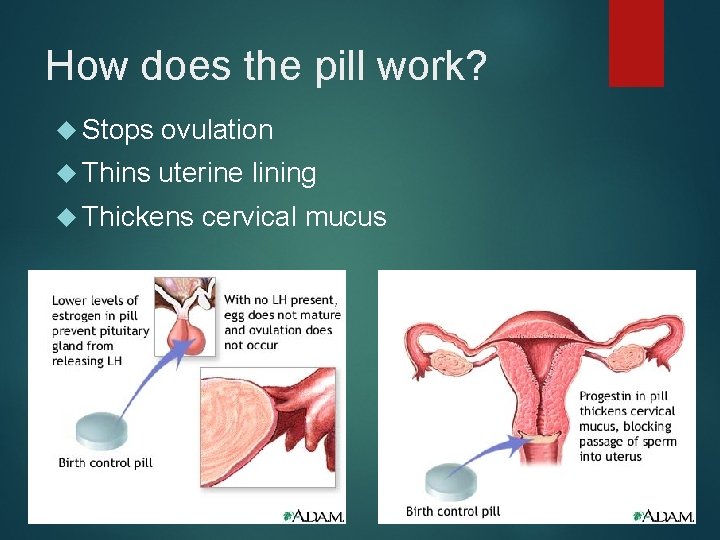 How does the pill work? Stops ovulation Thins uterine lining Thickens cervical mucus 