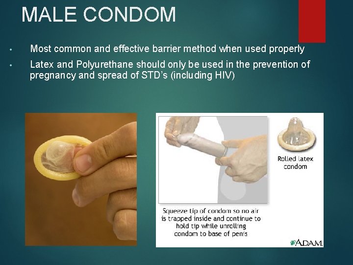 MALE CONDOM • Most common and effective barrier method when used properly • Latex