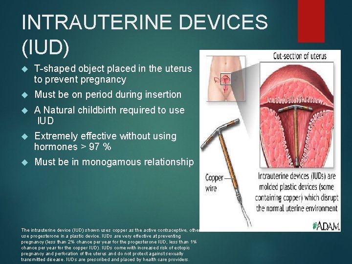INTRAUTERINE DEVICES (IUD) T-shaped object placed in the uterus to prevent pregnancy Must be
