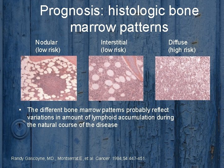 Prognosis: histologic bone marrow patterns Nodular (low risk) Interstitial (low risk) Diffuse (high risk)