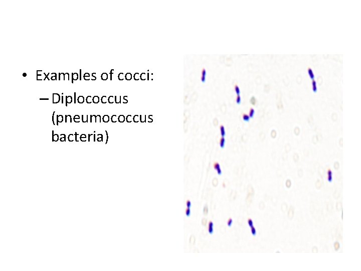  • Examples of cocci: – Diplococcus (pneumococcus bacteria) 