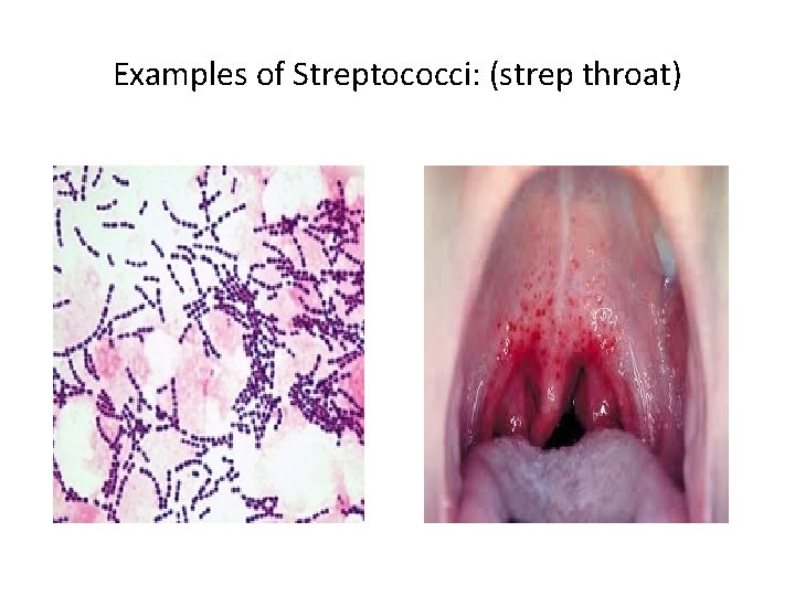 Examples of Streptococci: (strep throat) 