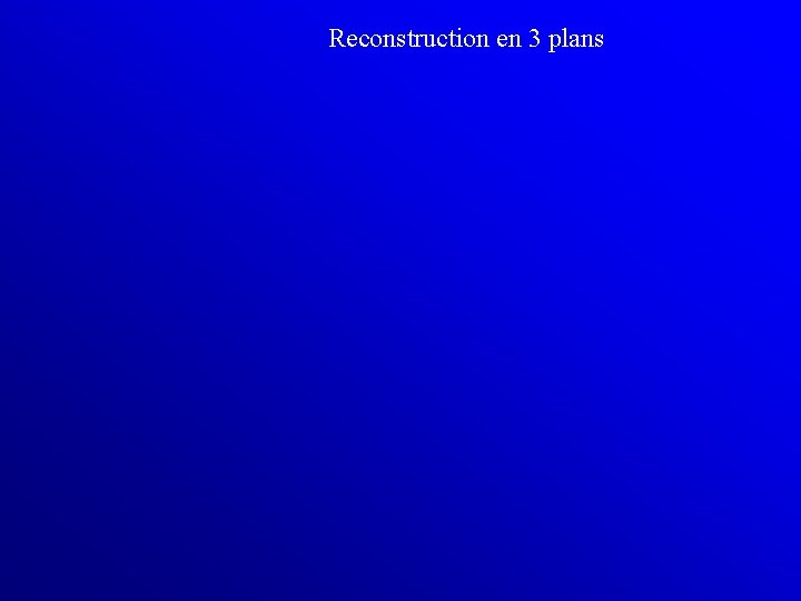 Reconstruction en 3 plans 