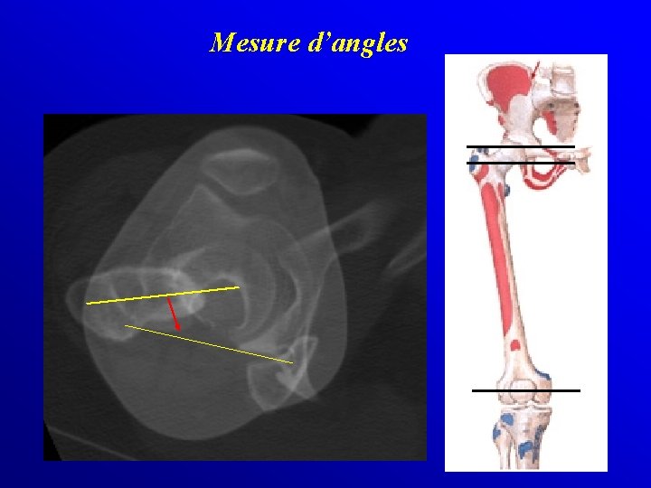 Mesure d’angles 