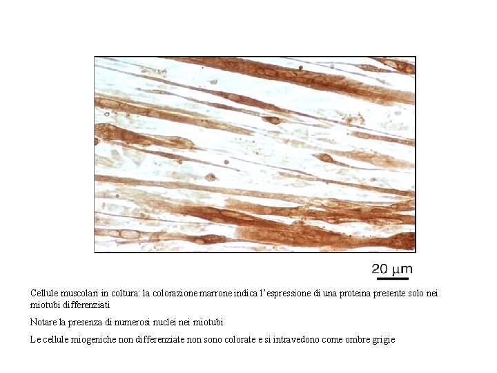 Cellule muscolari in coltura: la colorazione marrone indica l’espressione di una proteina presente solo