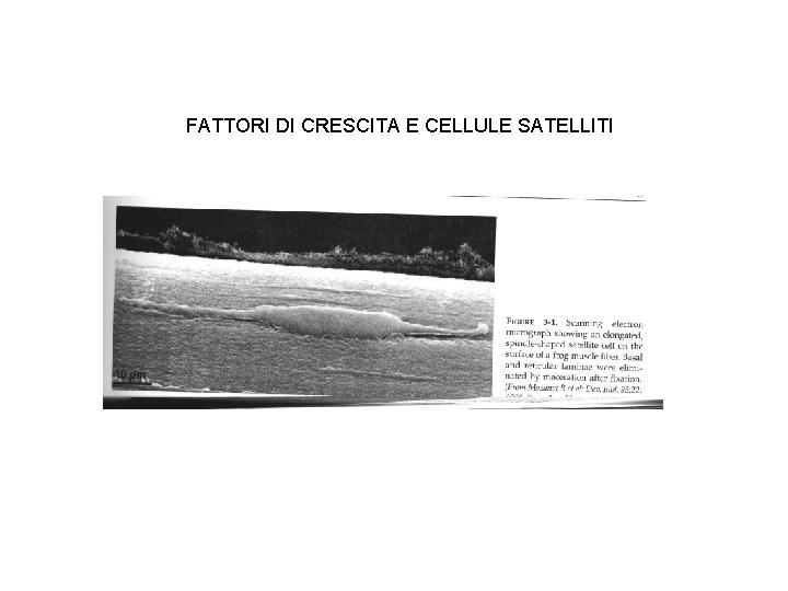 FATTORI DI CRESCITA E CELLULE SATELLITI 