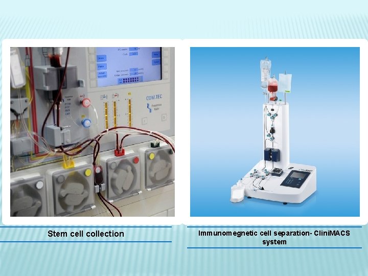 Stem cell collection Immunomegnetic cell separation- Clini. MACS system 