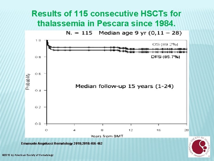 Results of 115 consecutive HSCTs for thalassemia in Pescara since 1984. Emanuele Angelucci Hematology