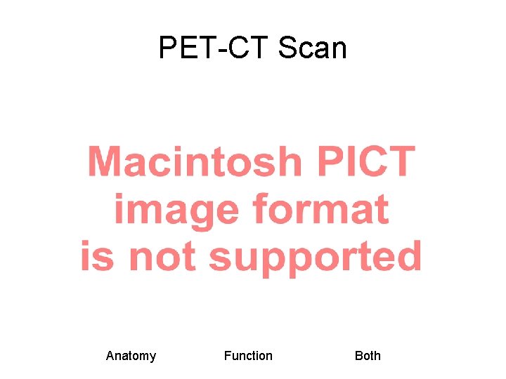 PET-CT Scan Anatomy Function Both 