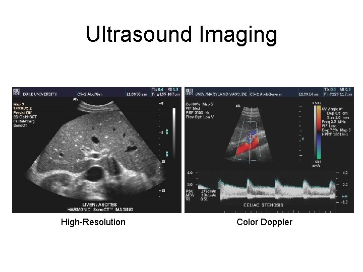 Ultrasound Imaging High-Resolution Color Doppler 