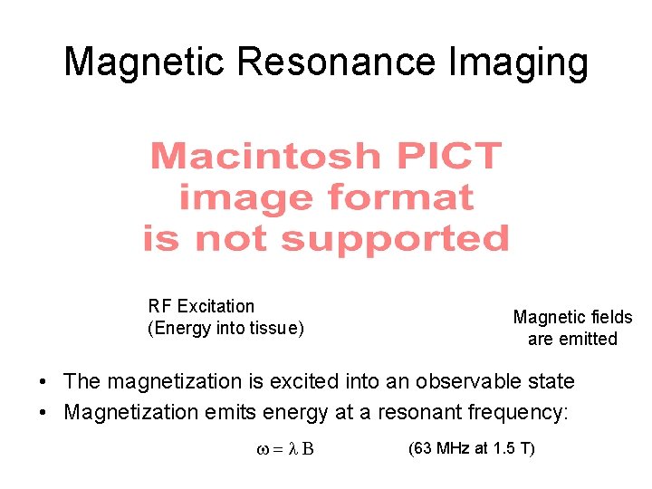 Magnetic Resonance Imaging RF Excitation (Energy into tissue) Magnetic fields are emitted • The