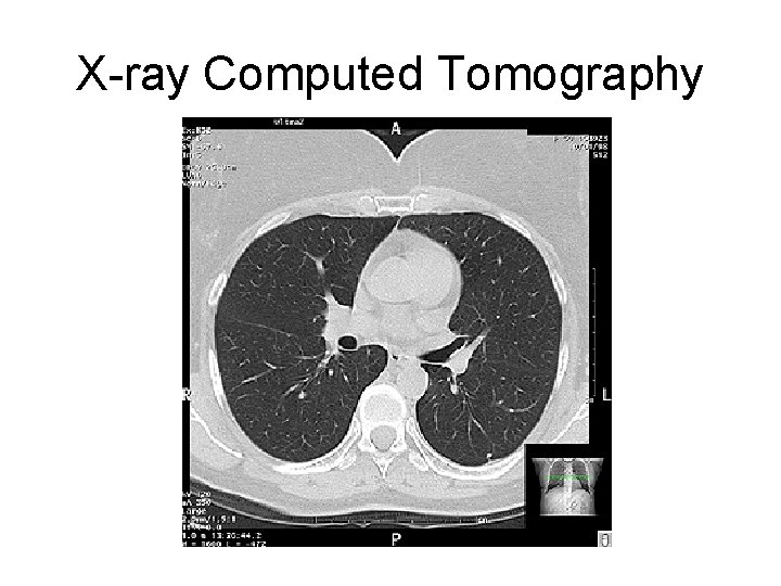 X-ray Computed Tomography 