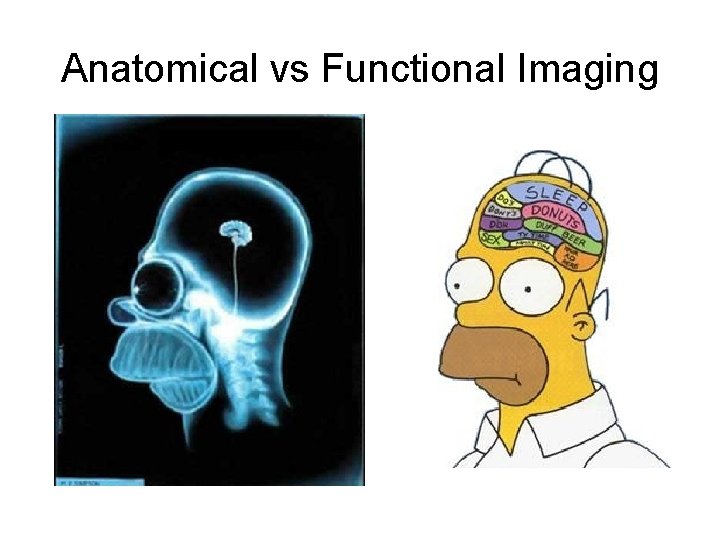 Anatomical vs Functional Imaging 