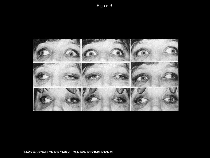 Figure 9 Ophthalmology 2001 1081313 -1322 DOI: (10. 1016/S 0161 -6420(01)00582 -6) 