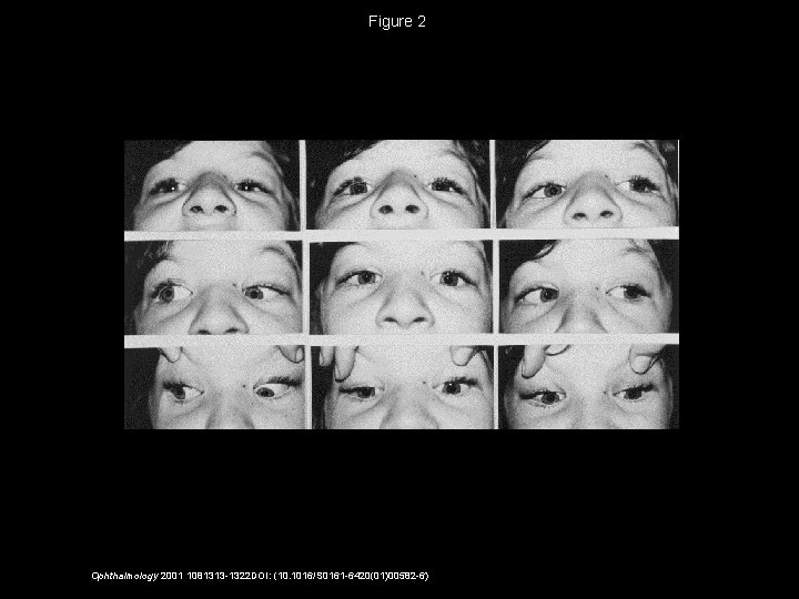 Figure 2 Ophthalmology 2001 1081313 -1322 DOI: (10. 1016/S 0161 -6420(01)00582 -6) 