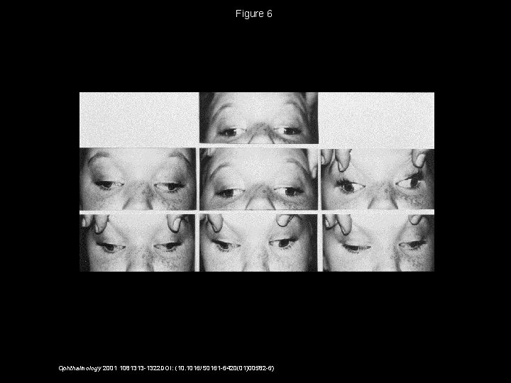 Figure 6 Ophthalmology 2001 1081313 -1322 DOI: (10. 1016/S 0161 -6420(01)00582 -6) 