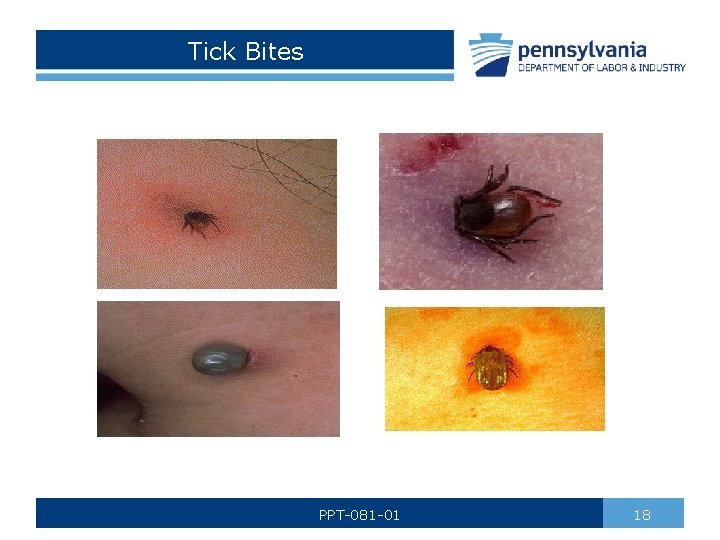 Tick Bites PPT-081 -01 18 